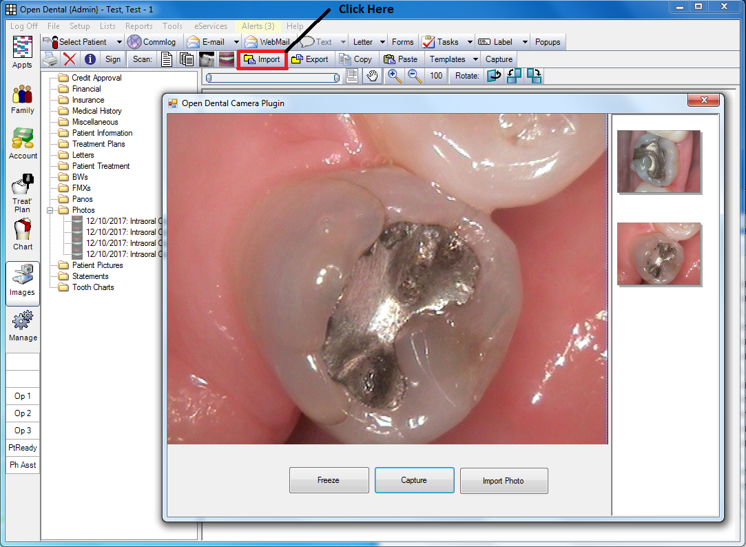 Dental Usb Software Download