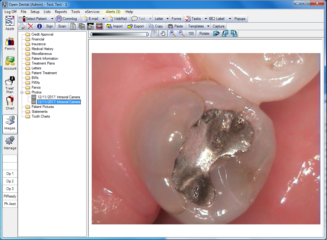 Open Dental Software - Insurance Refunds